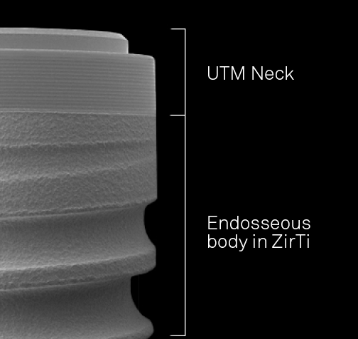 Premium One - 4 Endosseous Diameters, 1 Unique Connection